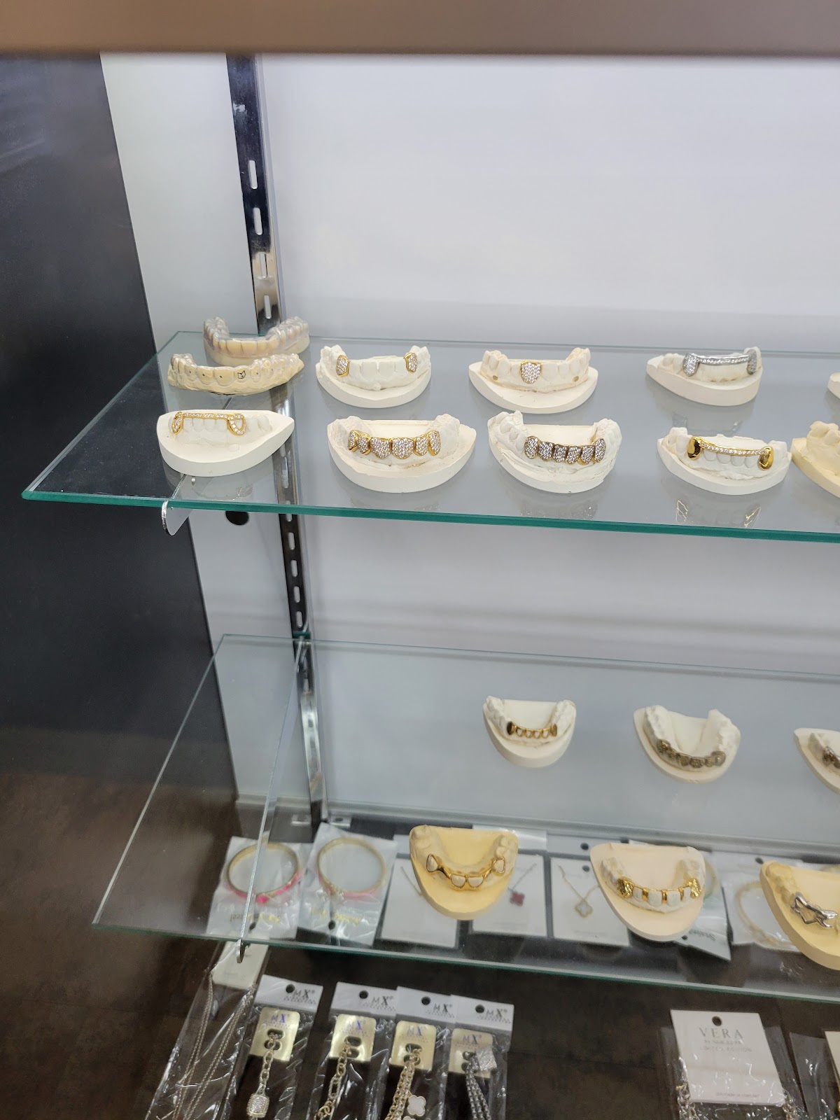 True Gold Grillz photo 4